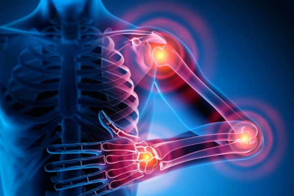 Rheumatology